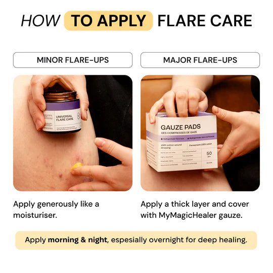 Universal Flare Care