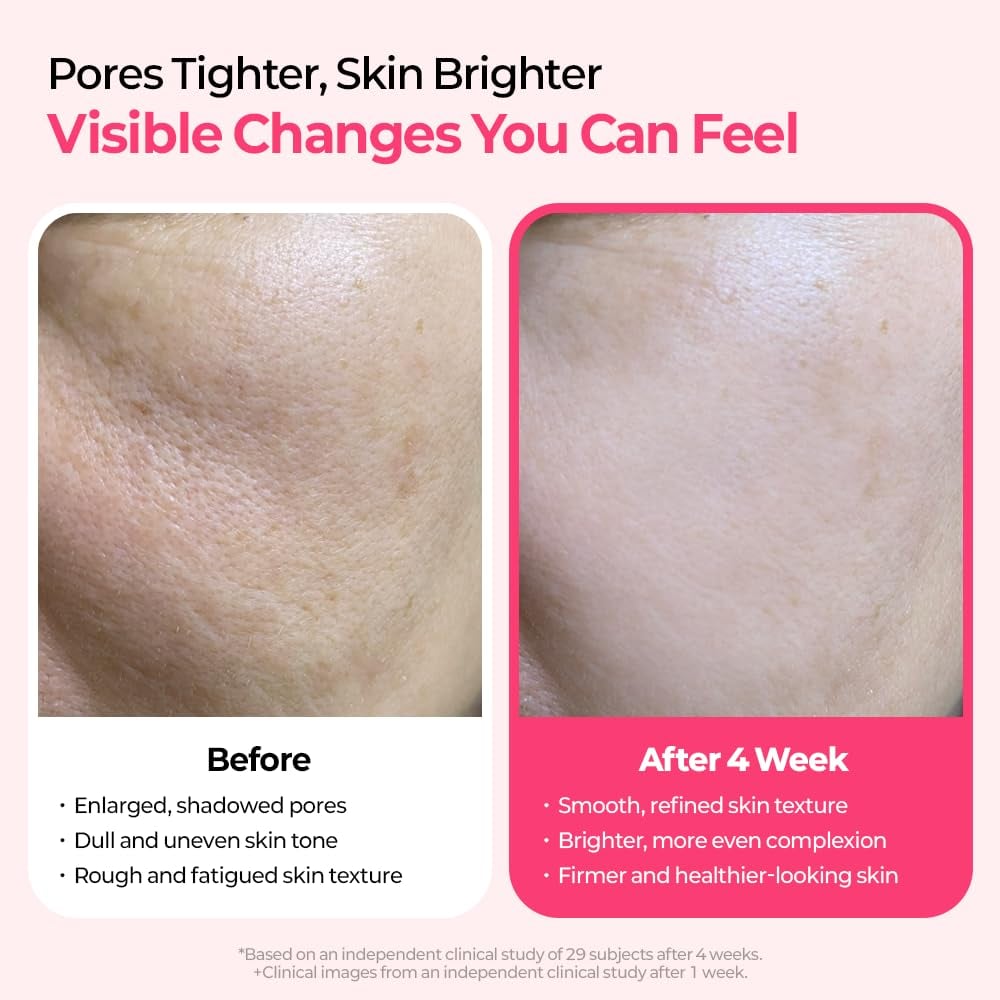 🔥Pore & Spot Care Duo