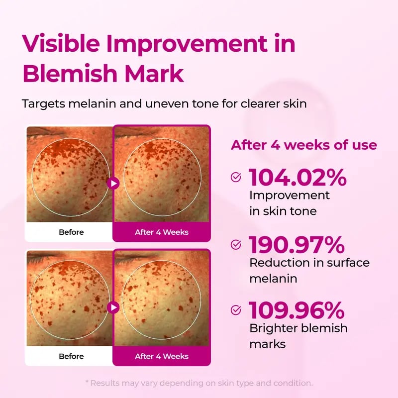 🔥Pore & Spot Care Duo