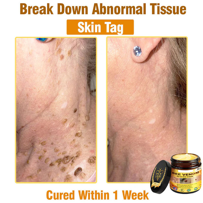Bee Venom All-in-One Cream US Dermatologist Approved🍃