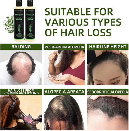 ViralLush Rosemary Shampoo