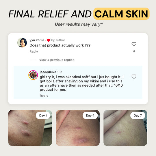 Universal Flare Care