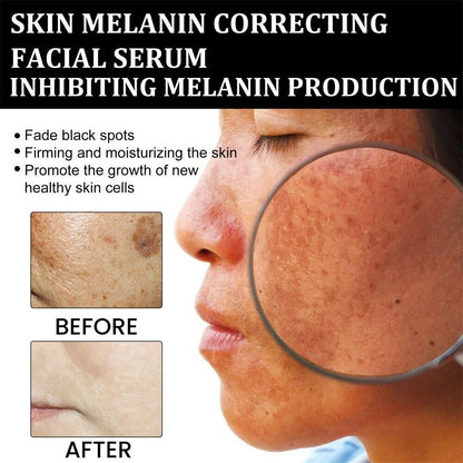 Fast Dark Spot Remover-Melanin Correcting Facial Serum