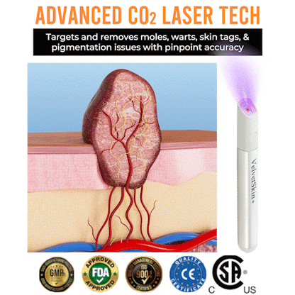 All-in-One CO₂ Laser Eraser Pen | Removes Moles, Warts, Skin Flaws & Pigmentation