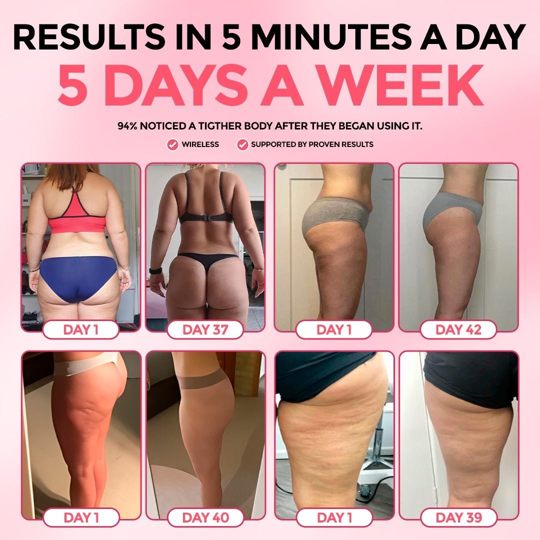 ViralLush™  Cellulite Relief Kit