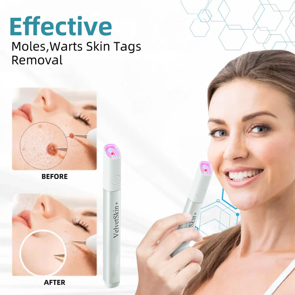 All-in-One CO₂ Laser Eraser Pen | Removes Moles, Warts, Skin Flaws & Pigmentation