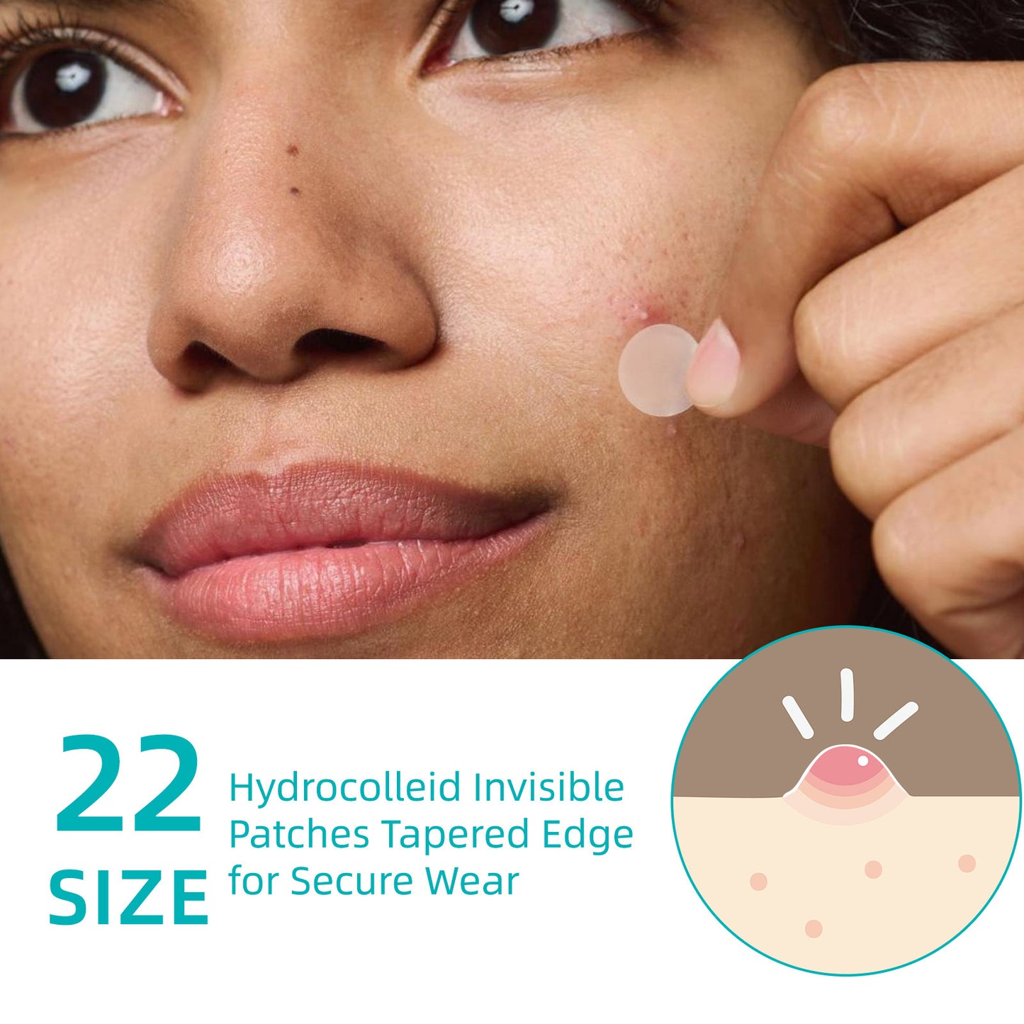 Blemish Barrier Patches