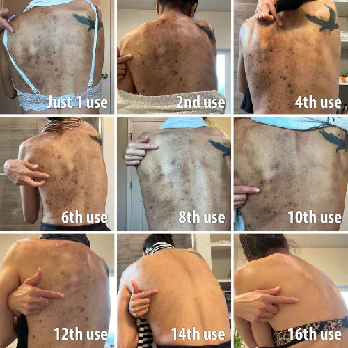 Fast Dark Spot Remover-Melanin Correcting Facial Serum