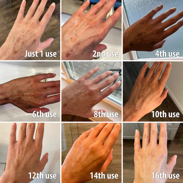 Fast Dark Spot Remover-Melanin Correcting Facial Serum