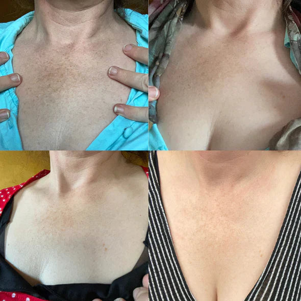 Fast Dark Spot Remover-Melanin Correcting Facial Serum