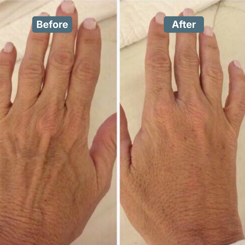 Retinol Body Lotion 6 oz with Shea Butter and Ceramides Skin Care Hydrating