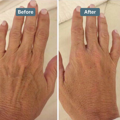 Retinol Body Lotion 6 oz with Shea Butter and Ceramides Skin Care Hydrating