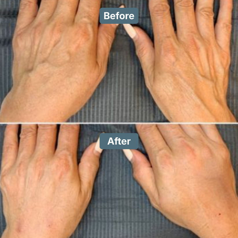 Retinol Body Lotion 6 oz with Shea Butter and Ceramides Skin Care Hydrating