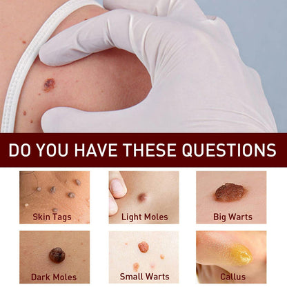 Tags & Moles Remover