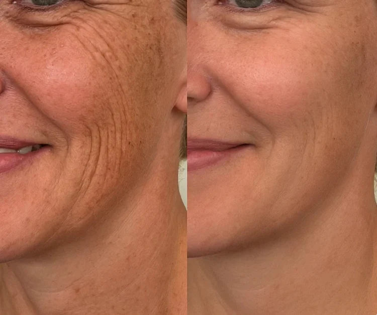 Dual Action Real Deep Collagen Sheets