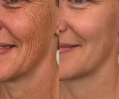 Dual Action Real Deep Collagen Sheets