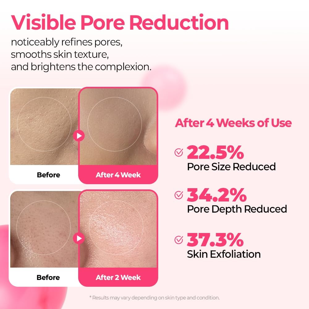 🔥Pore & Spot Care Duo