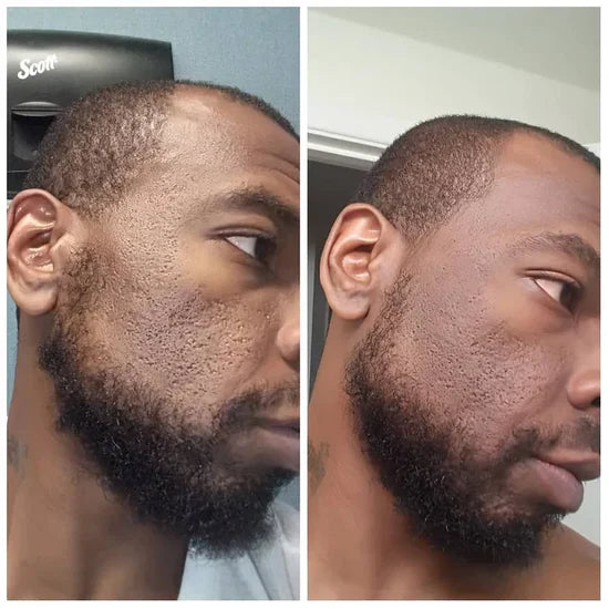 Radiant Blowout Routine Set | Dark Spot & Peeling Care