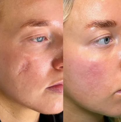 ViralLush™ Silicon ScarStick